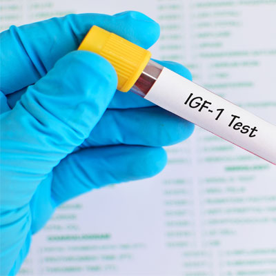 Relationship Between IGF-1 and Growth Hormone