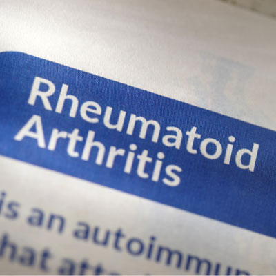 Facts about HGH for Rheumatoid Arthritis