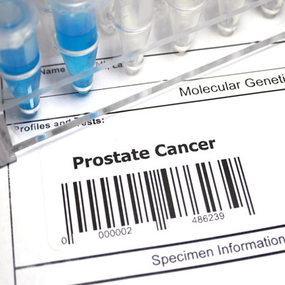 Prostate Cancer