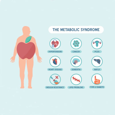 Testosterone and Metabolic Syndrome.