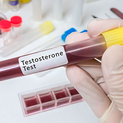 Testosterone Levels in Female