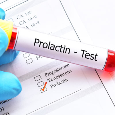 Prolactin Hormone Test