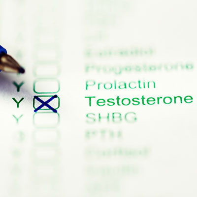 Blood Test for Testosterone