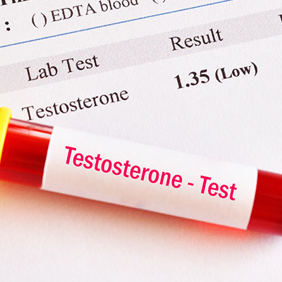 Free Testosterone and Total Testosterone