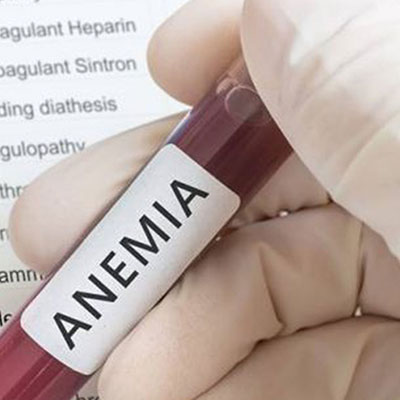 Anemia and Testosterone Deficiency