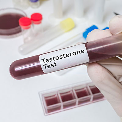 Low Testosterone.