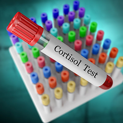 A Cortisol Blood Test.