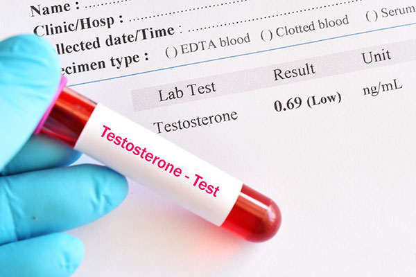 Why Women Need Testosterone