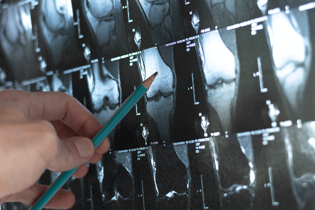 The effects of growth hormone