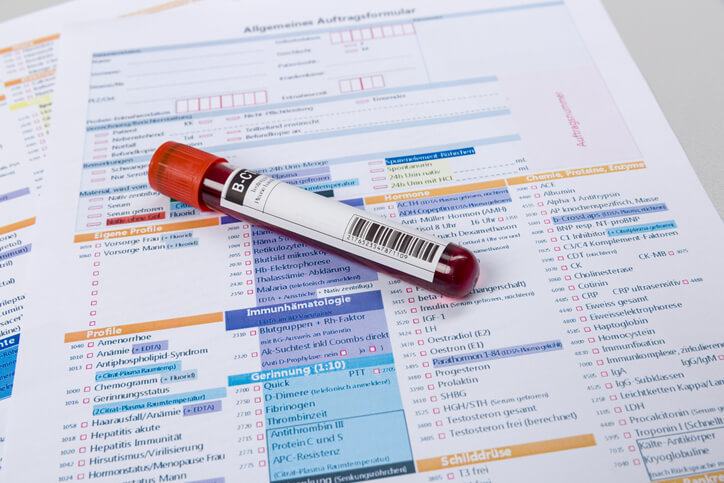 HRT results with comprehensive hormone blood testing