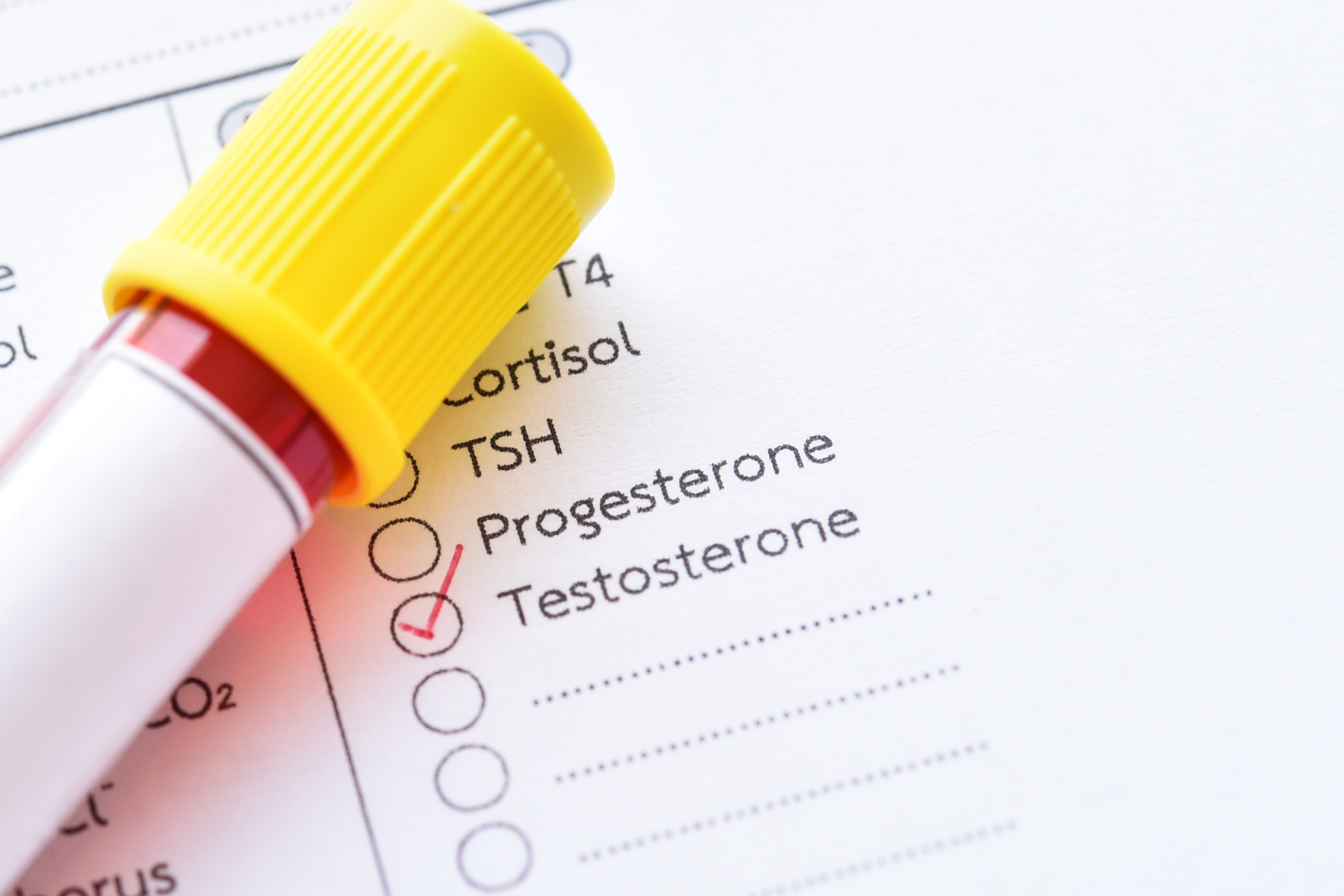 Myths About Testosterone Replacement Therapy