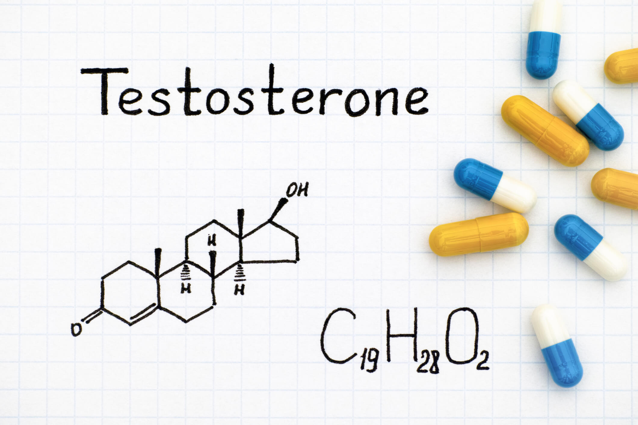 Testosterone test results