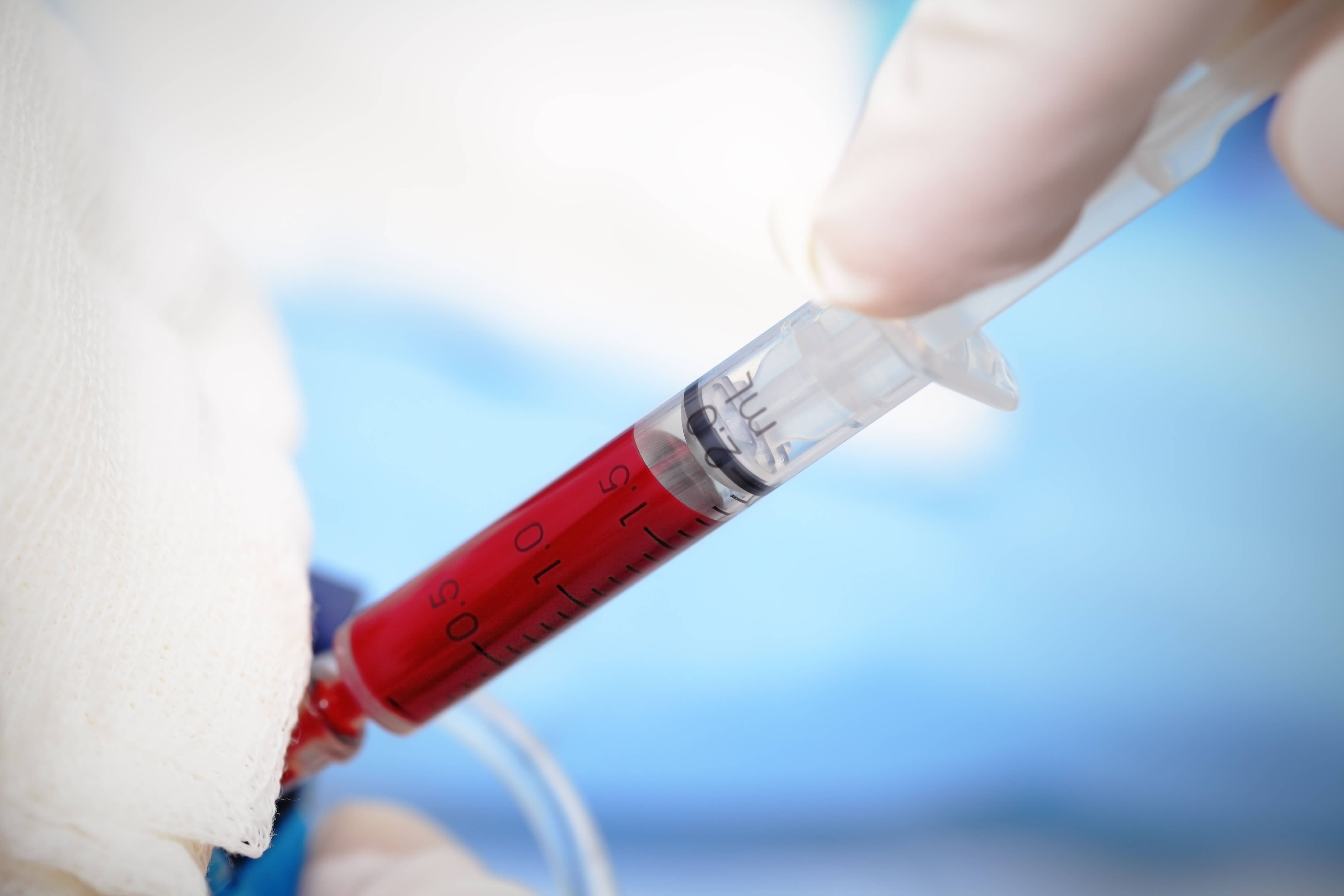 What Are the Normal HGH Levels for Adult Men and Women