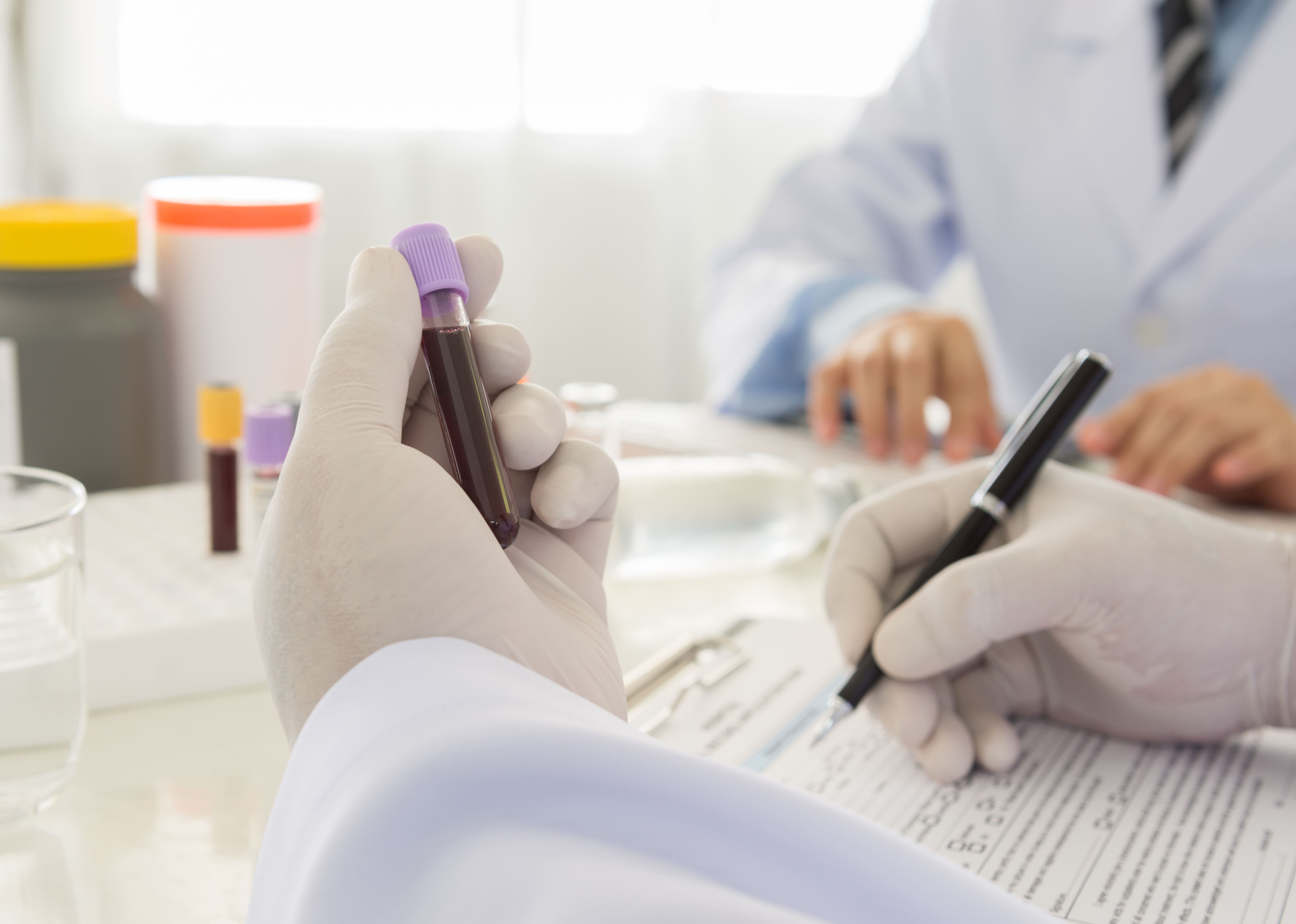 Lab Tests for HGH Therapy