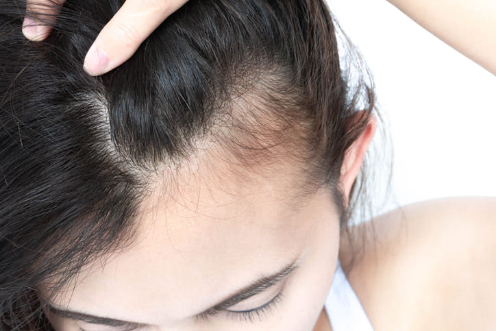 HGH Therapy for Promoting Thicker, Healthier Hair