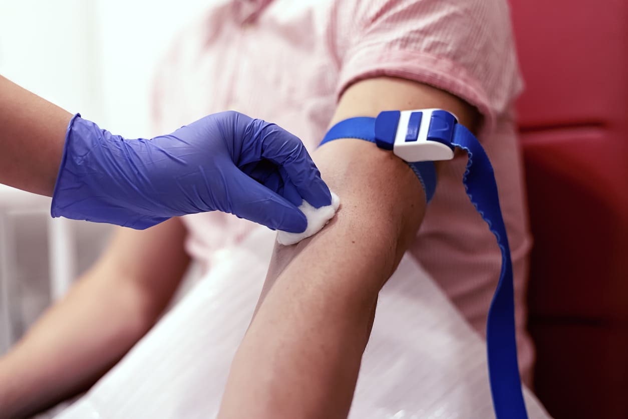 How Do I Prepare for an HGH Blood Test