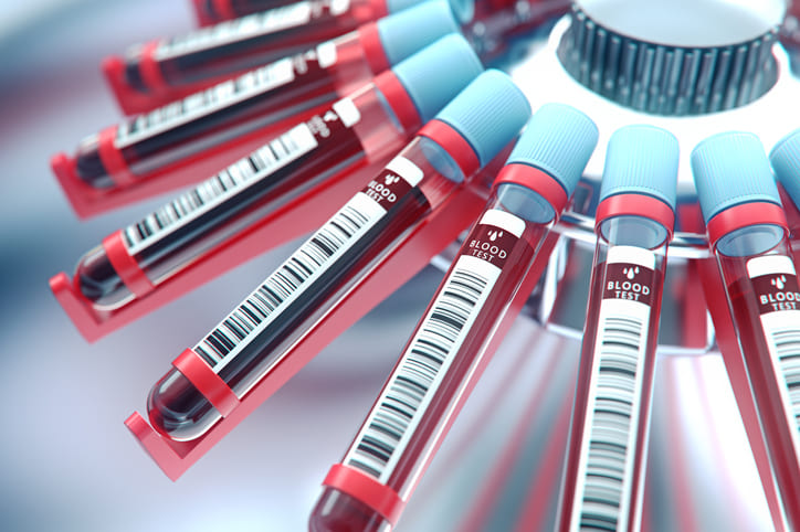 How Is HGH Deficiency in Adults Diagnosed