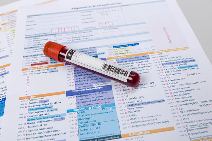 The Most Common Blood Tests for Diagnosing Growth Hormone Deficiency